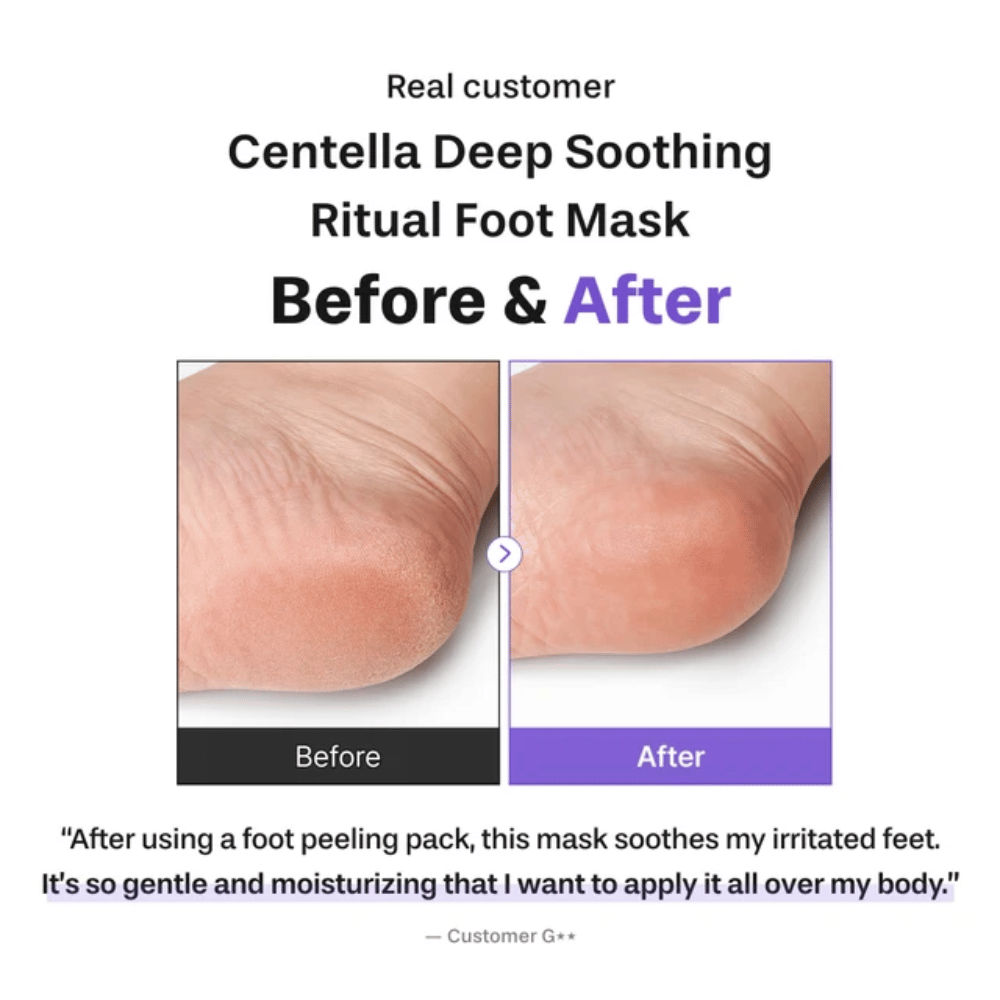 6. Baren Centella Deep Soothing Ritual Foot Mask – før- og etterbilde som viser en mykere og mer fuktet hæl etter bruk