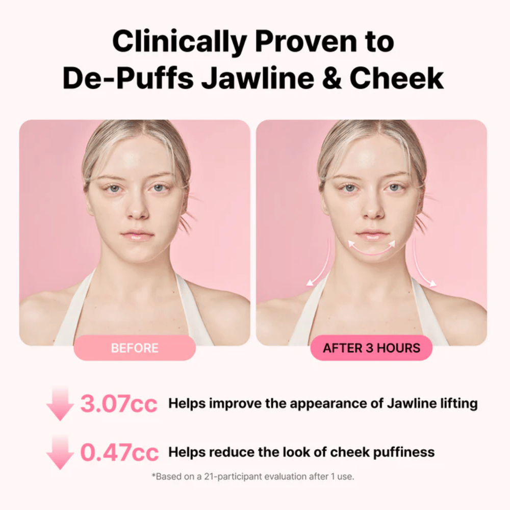Før- og etterbilde som illustrerer forbedret utseende av kjevelinjen og redusert hevelse etter bruk av RETURNITY Ear Therapy Acupressure Patch i tre timer.