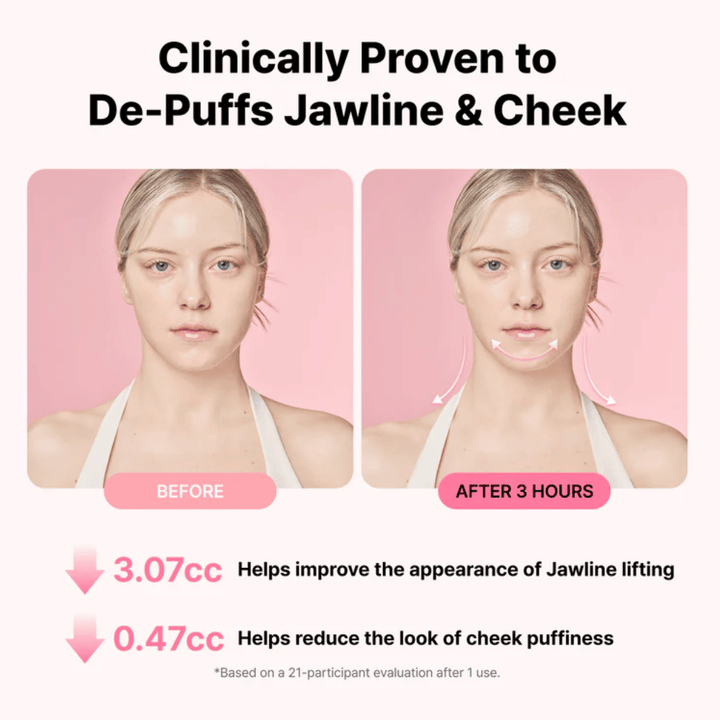 Før- og etterbilde som illustrerer forbedret utseende av kjevelinjen og redusert hevelse etter bruk av RETURNITY Ear Therapy Acupressure Patch i tre timer.
