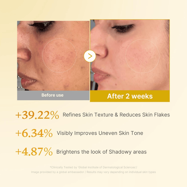 Før- og etterbilde for Medicube Kojic Acid Turmeric Resurfacing Toner som viser forbedret hudtekstur, jevnere hudtone og reduserte tørre hudflak etter to ukers bruk.