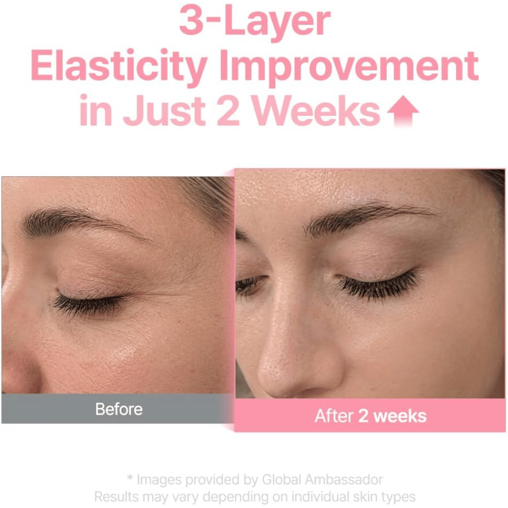 Før- og etterbilde for Purito Multi PDRN Collagen EGF Serum som viser forbedret hudelastisitet etter to uker.