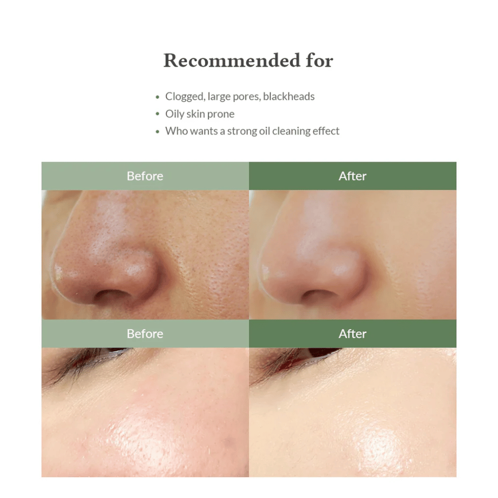 Dr. Althea Premium Quick Step Sebum Cleanser – ansiktsrens som hjelper til med å redusere hudormer, rense porer i dybden og gi en jevnere hudstruktur.