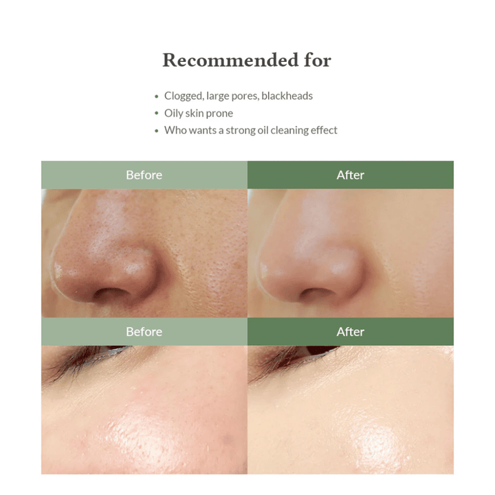 Dr. Althea Premium Quick Step Sebum Cleanser – ansiktsrens som hjelper til med å redusere hudormer, rense porer i dybden og gi en jevnere hudstruktur.